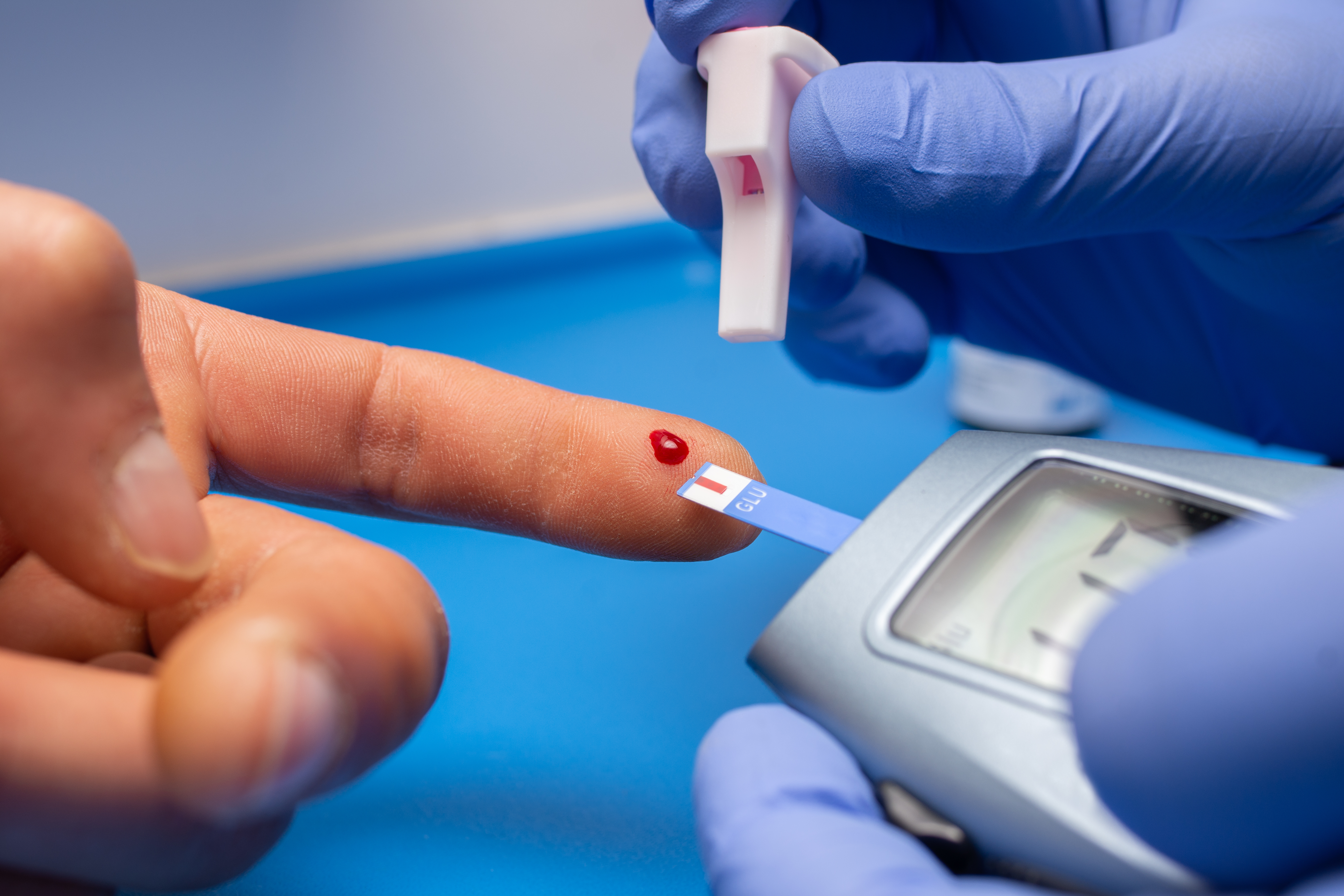 Diabetes: tipos, síntomas y estrategias para un control efectivo